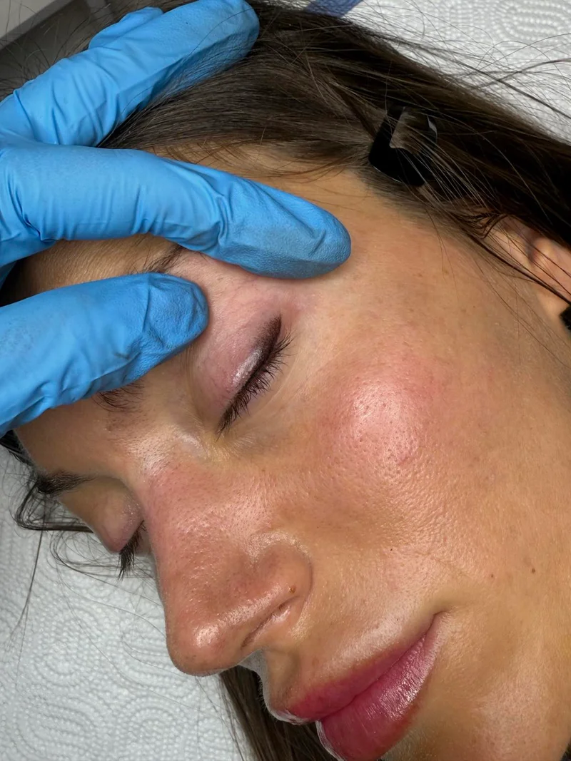 Trajni ajlajner - Precizna linija