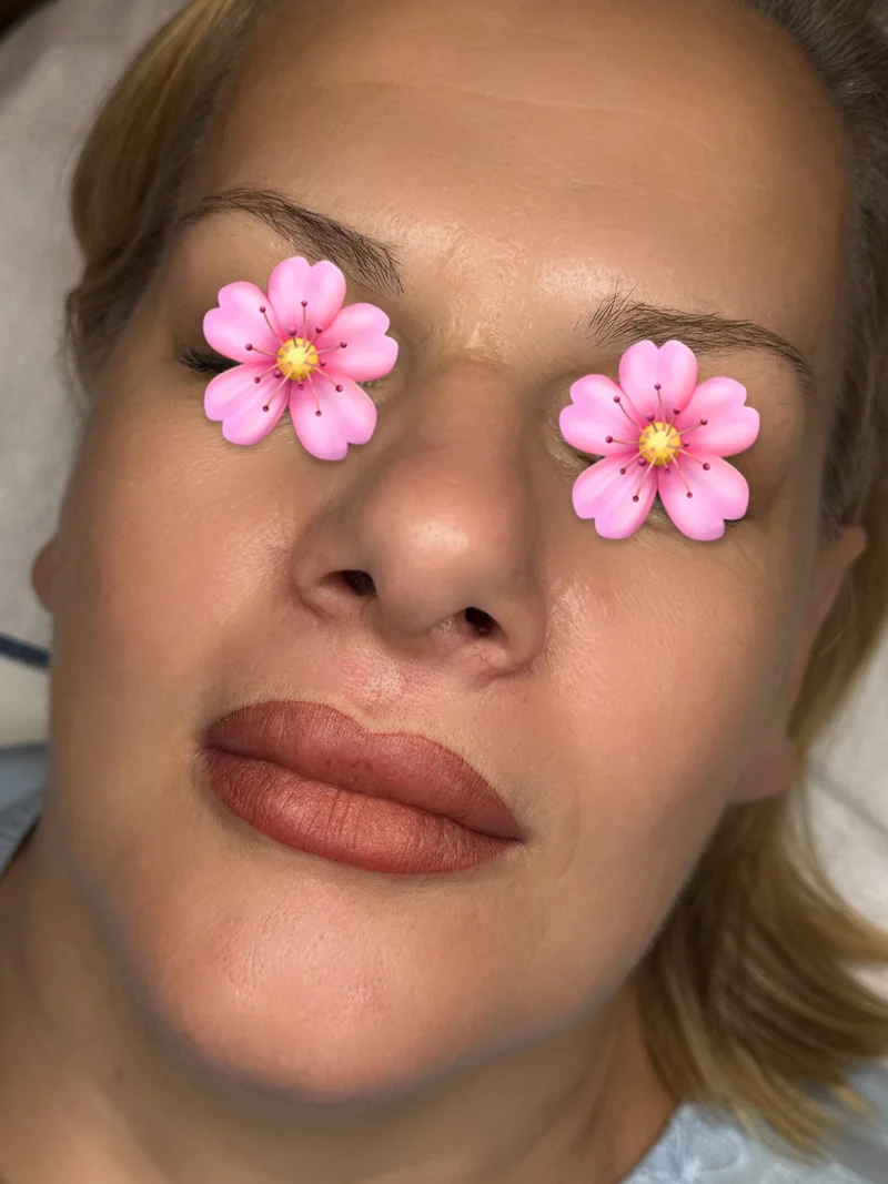 Trajna šminka usana - Savršen oblik